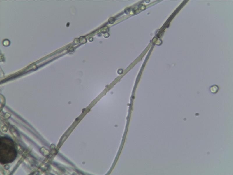 Diderma nivale.......